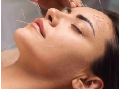 Đau nửa đầu: nguyên nhân , triệu chứng và cách điều trị