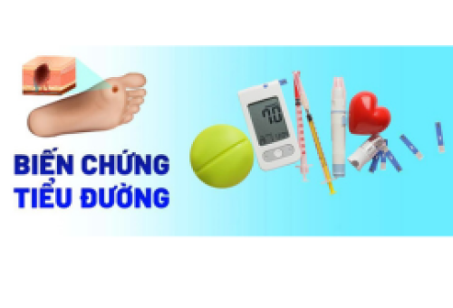 Các biến chứng bệnh tiểu đường? Cách phòng ngừa bệnh tiểu đường như thế nào? Chế độ dinh dưỡng ra sao? 